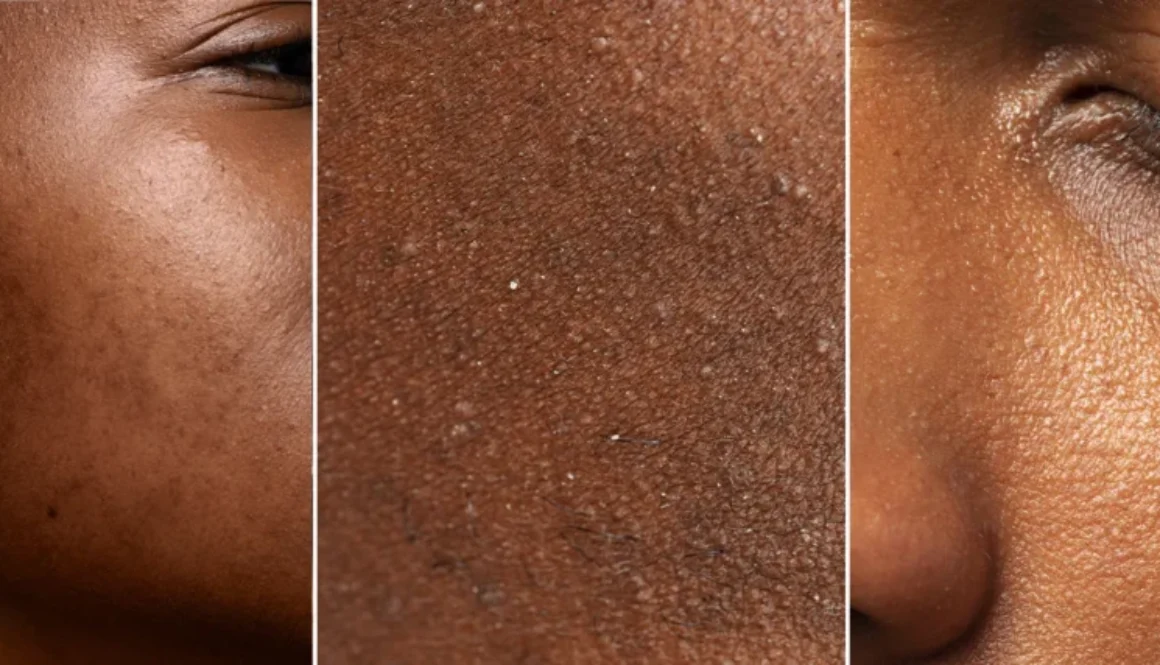 How-To-Tell-On-Darker-Skin-Tones-Gentle